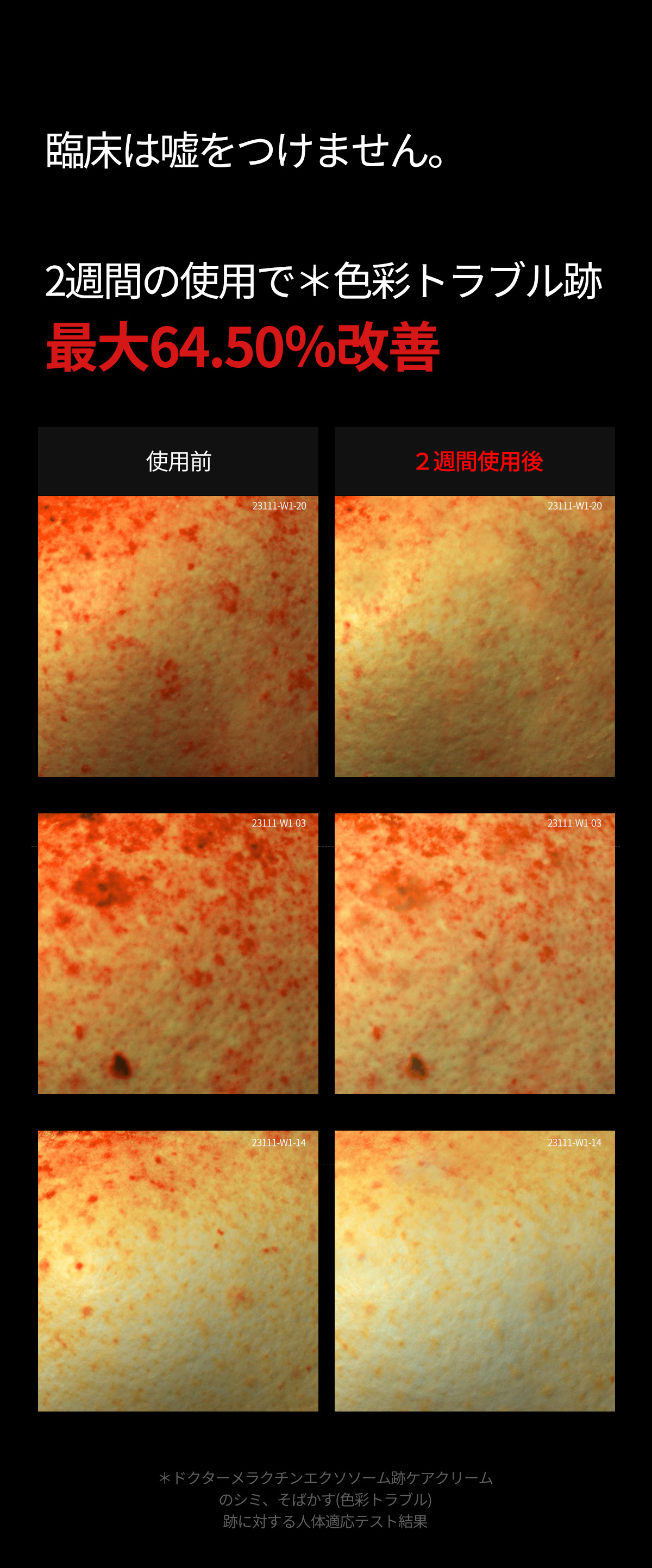 エクソソーム トラブル跡ケアアンプル | Dr.MELAXIN