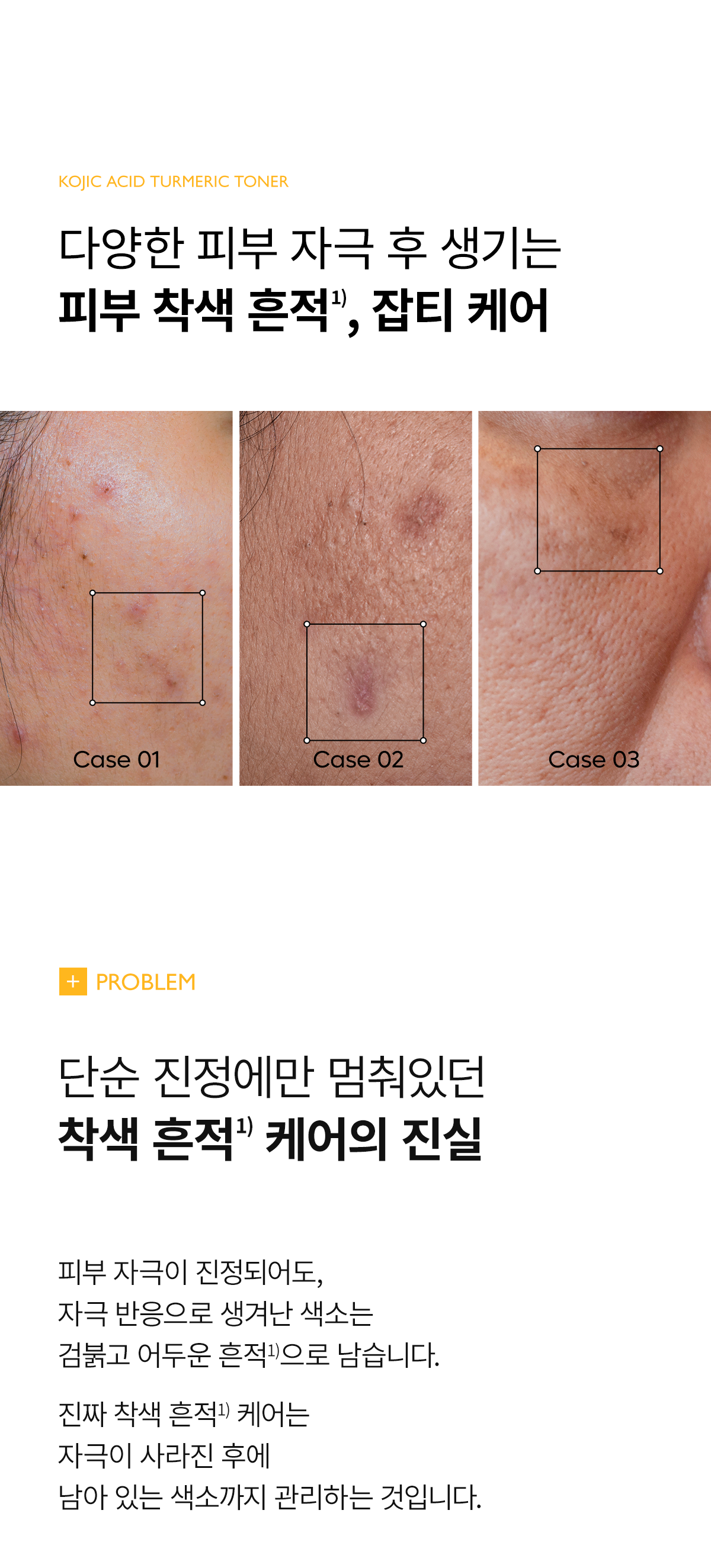 DR.MELAXIN Kojic Acid Turmeric Toner - description 2