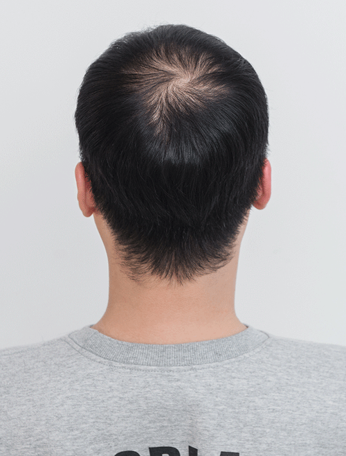 Human Hair 100% Full Wig  Multi-Section O