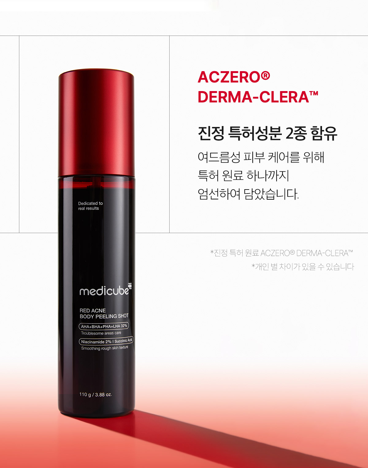 240429_peeling02_11.jpg?QT=80